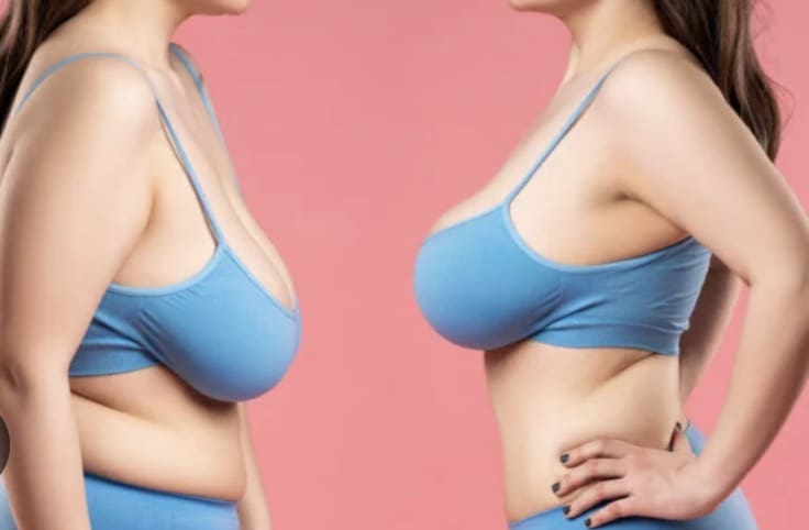 Two women in blue sports bras are shown from the side and front against a pink background, highlighting their upper bodies and posture differences.